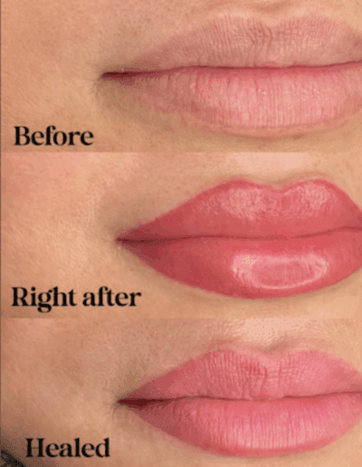 Before during and after lips.